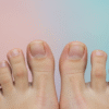Long Toenails problem